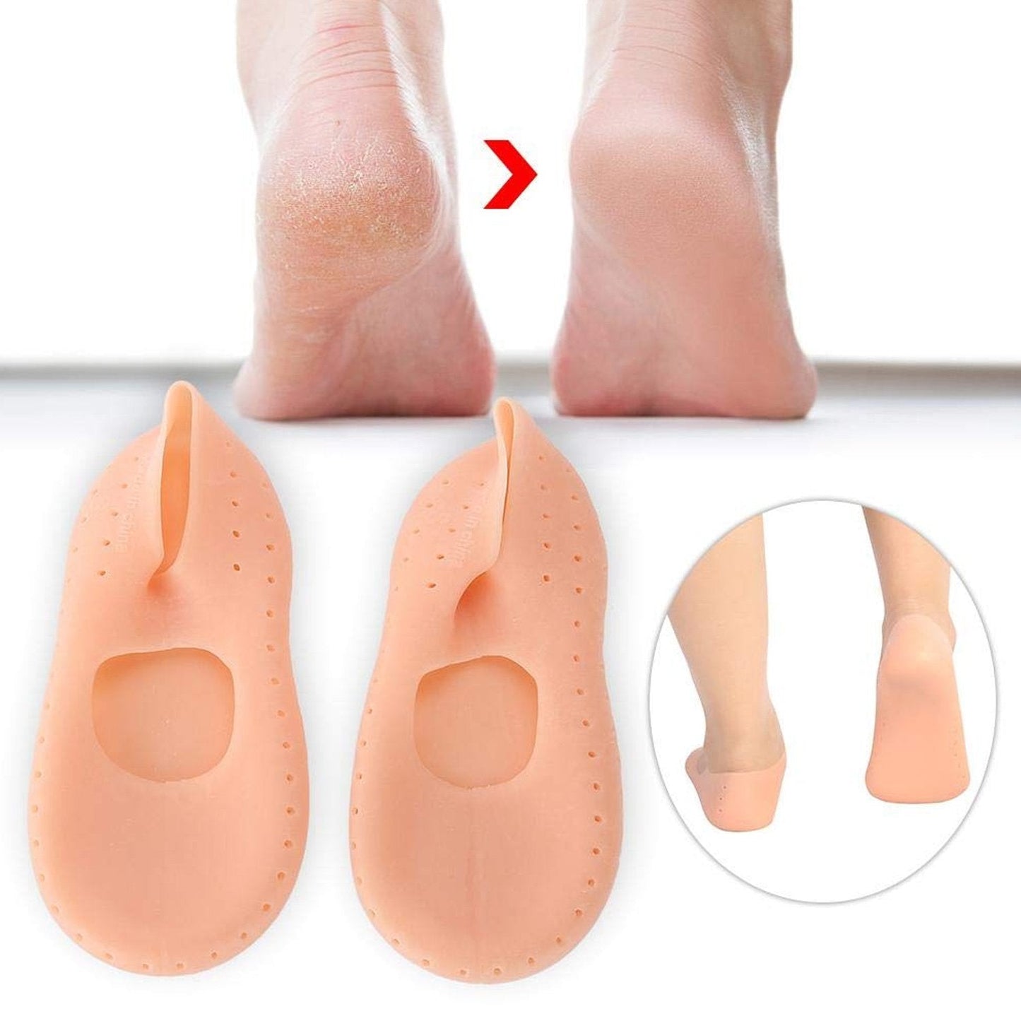 Two peach silicone heel socks with a before and after comparison of cracked heels and a person wearing the socks.