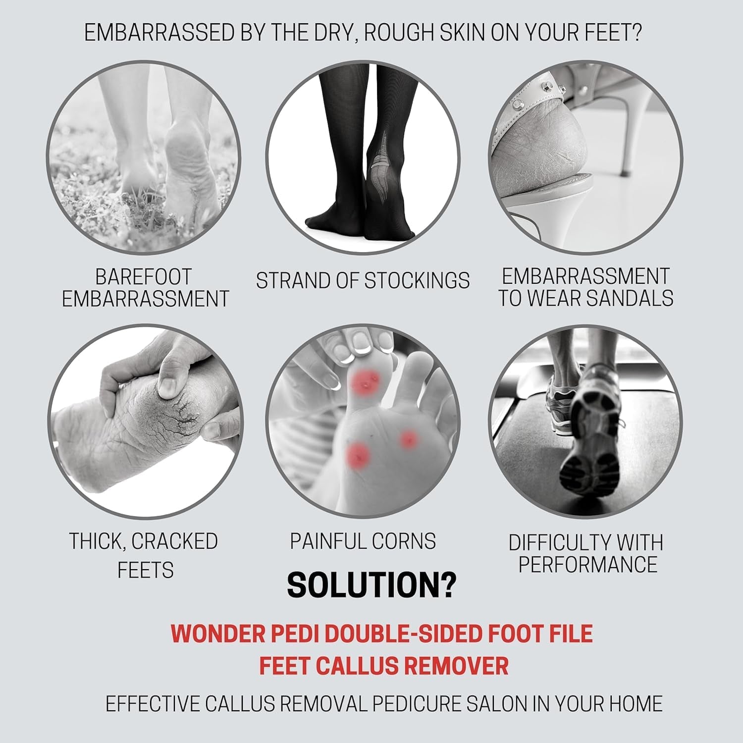 A graphic showing common foot problems like cracked heels and corns, with the foot file presented as a solution.