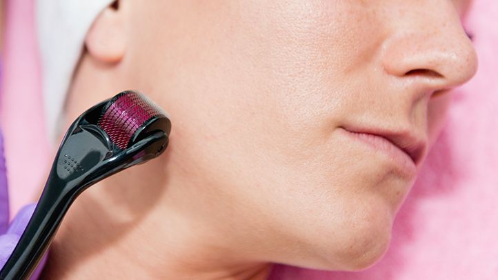 A close-up of a woman's lower face as she uses a black derma roller with a purple head on her jawline.
